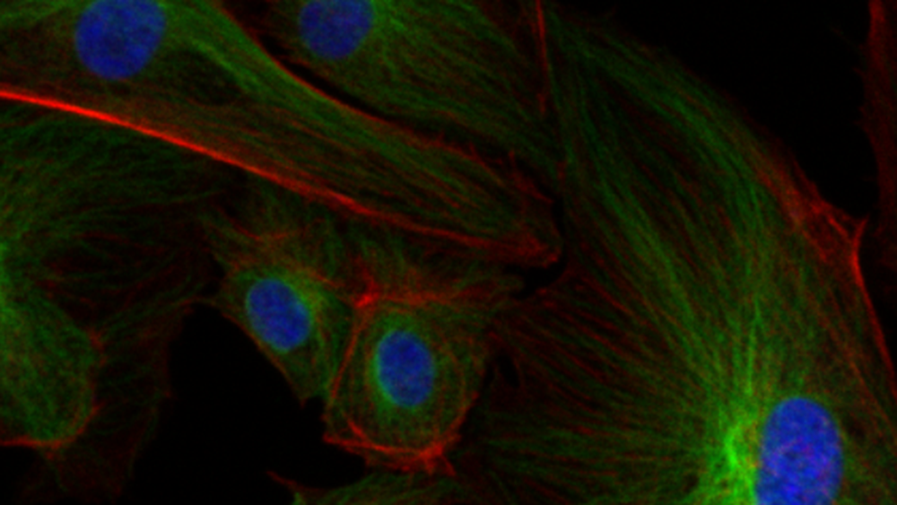 HeLa cells imaged using fluorescence microscopy